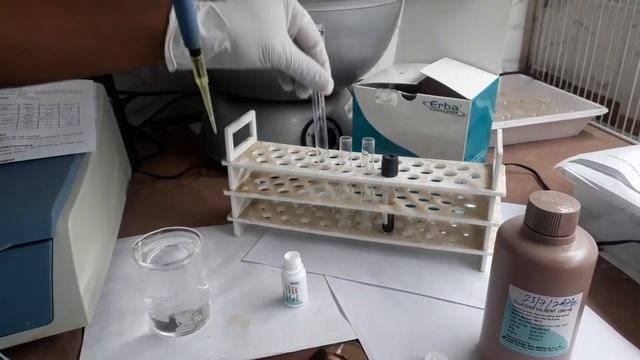 Blood Sugar/Glucose Test Procedure in Semiautomatic Biochemistry analyser by GOD-POD Method смотреть онлайн