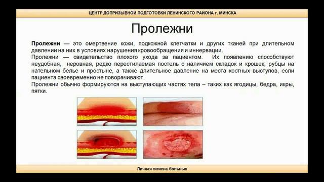 Тема 5. Личная гигиена больных смотреть онлайн
