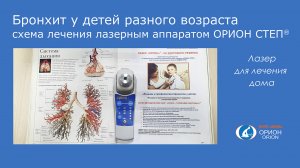Лечение бронхита с помощью лазерного аппарата ОРИОН СТЕП