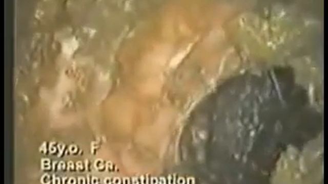 кишечник внутри смотреть онлайн