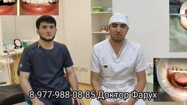 СТОМАТОЛОГИЯ ДЛЯ МИГРАНТОВ | КОСТОЛОМ УЗБЕКИСТАН | ДОКТОР ФАРУХ | УЗБЕКИ ТАДЖИКИ КЫРГЫЗЫ