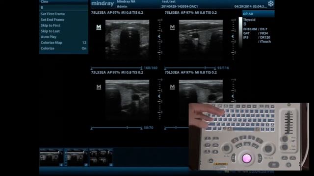 Mindray DP 50 смотреть онлайн