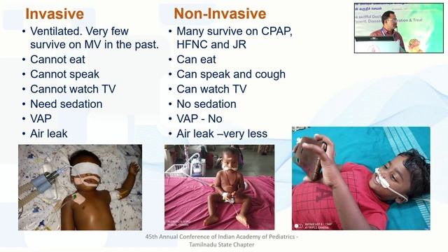 Simpler Non Invasive Ventilation Techniques for Practising Pediatricians - Dr. J Balaji смотреть онлайн