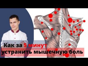 Тригерные точки в мышцах: как быстро найти и устранить мышечную боль.
