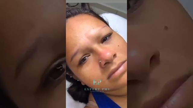 Где вы находите этих мастеров ? #лазерноеудаление #удалениетатуажа смотреть онлайн