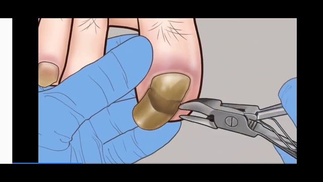 СКАЧАЛ ATOMIC HEART НА ТЕЛЕФОН? КЛОНЫ АТОМИК ХЕАРТ!