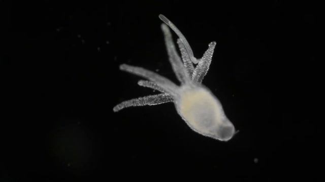 Hydra vulgaris - Darkfield microscopy смотреть онлайн