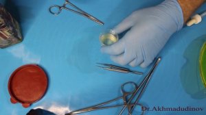 Лечение маслом и спиртом  Метод Шевченко