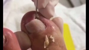 ЧЕРВИ у собаки! новое МЕРЗКО, выдавливание и еще много выдавливания.