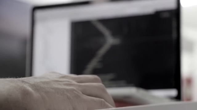ДЯДЯ Х ► 10 СЕРИЙ В 1 ► ПЕРВАЯ СЕРИЯ ► МИНУТКА ШИЗЫ смотреть онлайн