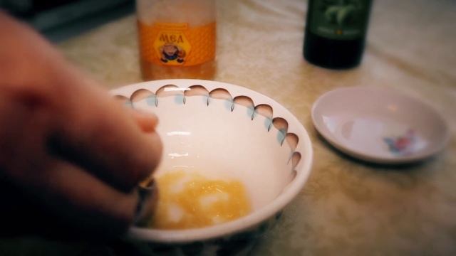 Лечение пяточной шпоры