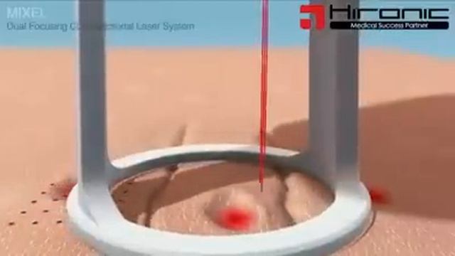 HOW'S CO2 LASER WORKS? смотреть онлайн