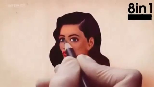 Supervenus