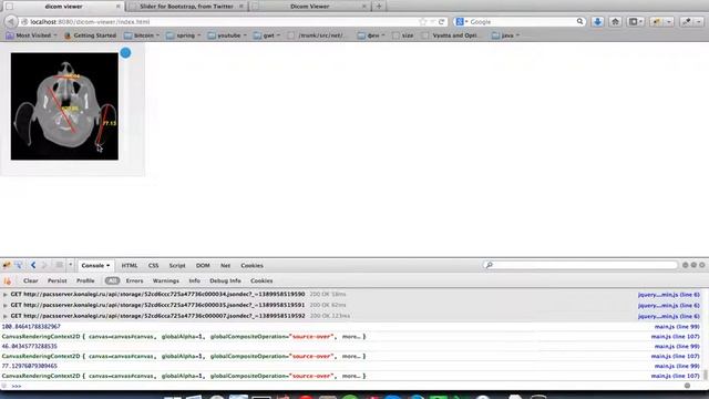 dicom-viewer-2 смотреть онлайн