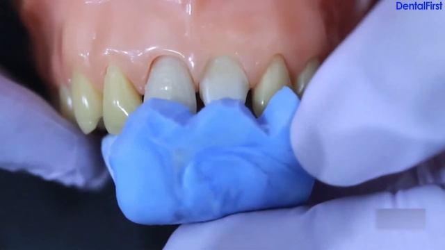 Structur 2 - эстетика временных конструкций