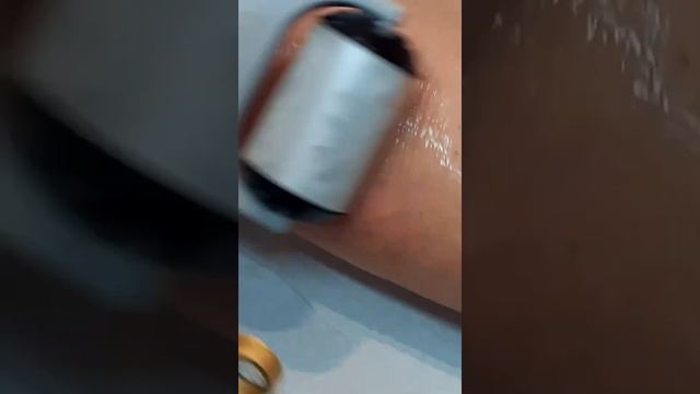 [CLDE Marseille] varicosités par laser excel V смотреть онлайн