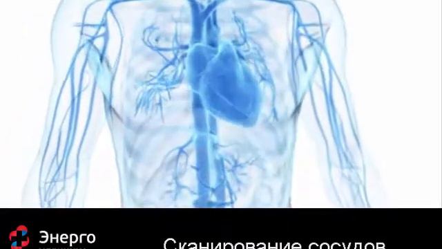 Сканирование сосудов в диагностическом центре ЭНЕРГО смотреть онлайн
