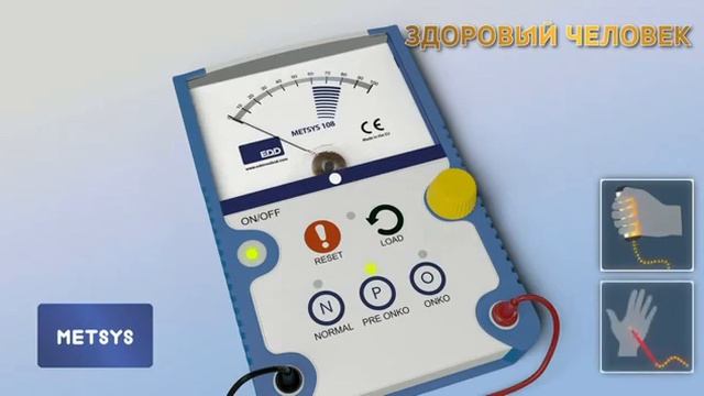 МЭТСИС(METSYS)