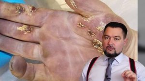 Электрический ток поражает! Какие бывают электротравмы #энерголикбез