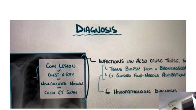 Lung cancel presentation, Dr.H.G.Vyas. Prof.Surgery Dept.RMC.Loni смотреть онлайн