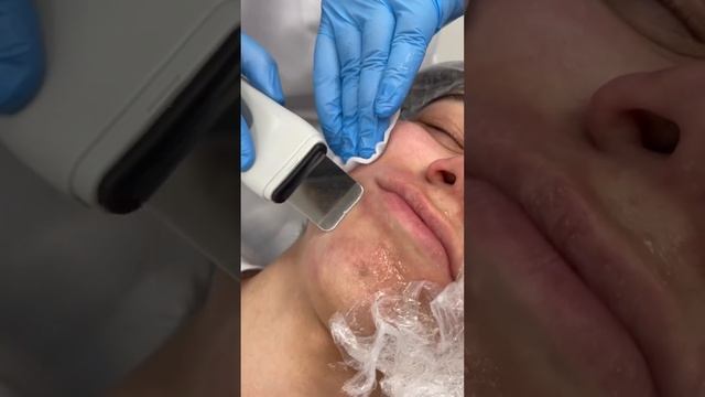 Комбинированная чистка лица смотреть онлайн