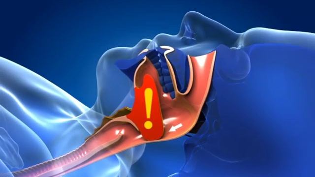 Апноэ смотреть онлайн