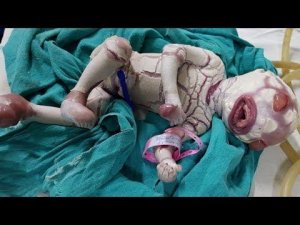 9 Необычных Детей, Которые Действительно Существуют