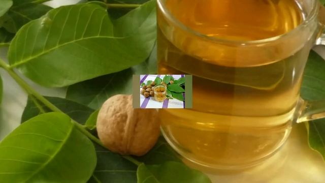 Тери Касалликлари Кийнаяптими ??? смотреть онлайн