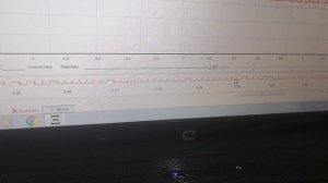 Chevrolet lanos устранение проблем по датчику фаз.