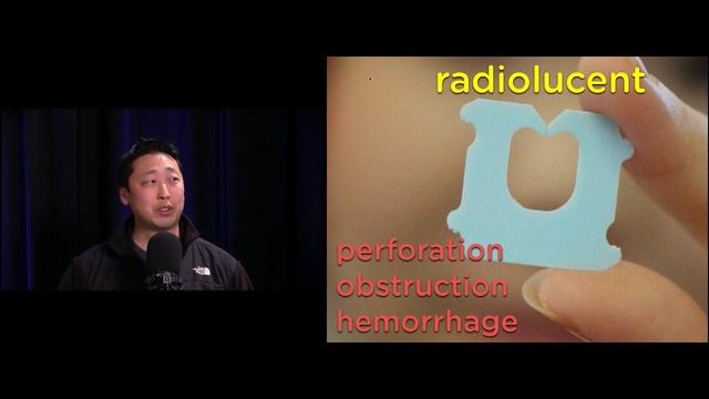 Hippo EM's The LLSA Show: Foreign Body Imaging смотреть онлайн