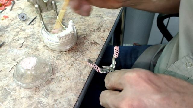 Изготовление бюгельного протеза Покрываем сёдла лаком смотреть онлайн