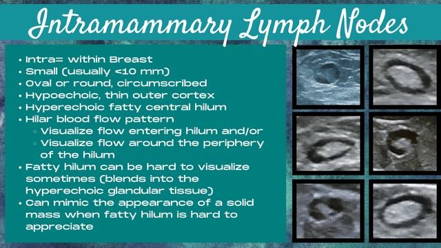 Breast Ultrasound (Axillary vs Intramammary Lymph Nodes) смотреть онлайн