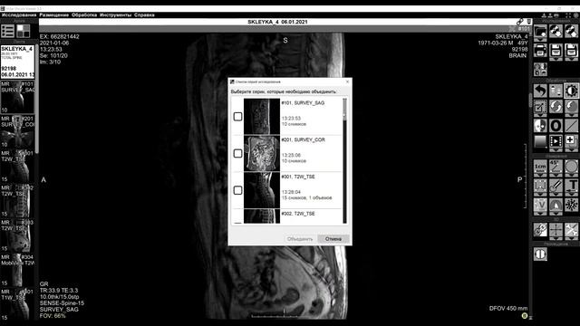Обучающее видео "Объединение серий в МРТ" смотреть онлайн