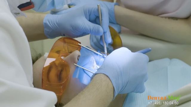 Лечение корневых каналов под микроскопом смотреть онлайн