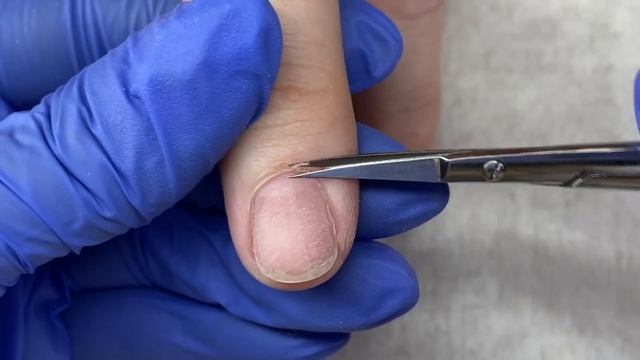 Ногти ОГОРОДНИКА?Подробный срез ножницами?Лайфхак с мицеллярной водой?Аппаратный маникюр смотреть онлайн