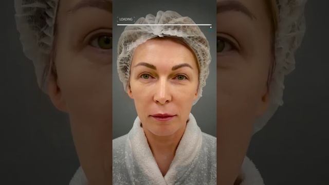 Преображение от пластического хирурга клиники DEGA Четвериковой М.А. ? смотреть онлайн