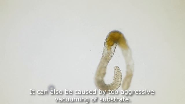 Detritus Worms: What Is It and How to Get Rid of Them. Detritus Worms Under a Microscope смотреть онлайн
