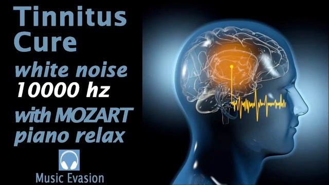 TINNITUS CURE WHITE NOISE 10000 Hz With MOZART PIANO RELAX