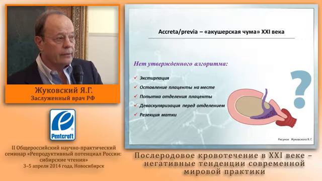 Послеродовое кровотечение в 21 веке засл врач РФ ЯГ Жуковский 2014 смотреть онлайн