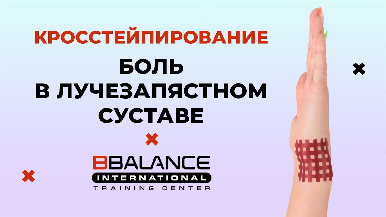 Кросстейпирование при боли в лучезапястном суставе смотреть онлайн