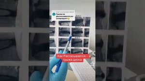 Как рассасываются межпозвоночная грыжа диска. Резорбция грыжи