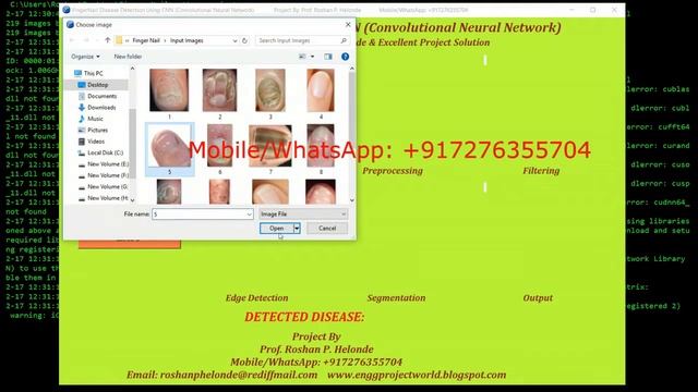FingerNail Disease Detection Using CNN | Python Project Source Code Final Year Projects #SourceCode смотреть онлайн
