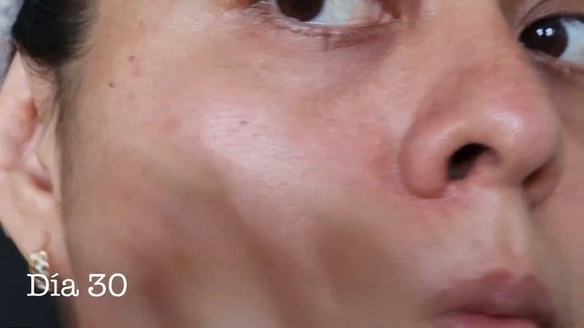 Puse a prueba Vichy B3 Sérum ANTI-MANCHAS ¿el mejor suero despigmentante? RESEÑA con RESULTADOS смотреть онлайн