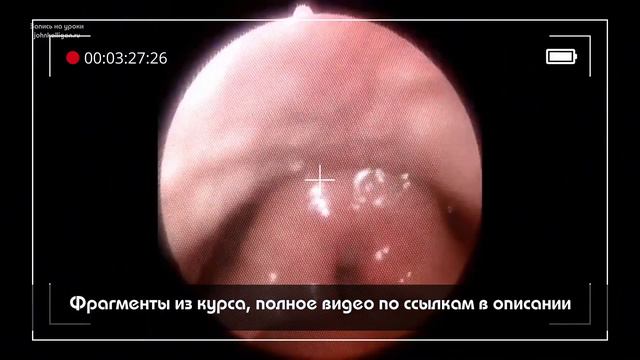 РАСЩЕПЛЕНИЕ, Драйв, Скрим, Харш (Вокальный Курс 10/11) смотреть онлайн