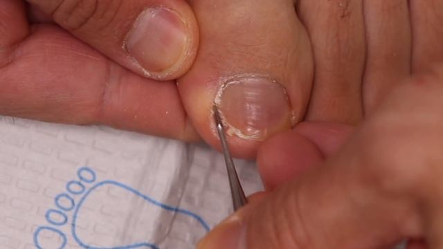 DO YOU CUT STRAIGHT ACROSS OR DOWN THE SIDE?! ***HOW TO CUT YOUR TOENAILS 101*** смотреть онлайн