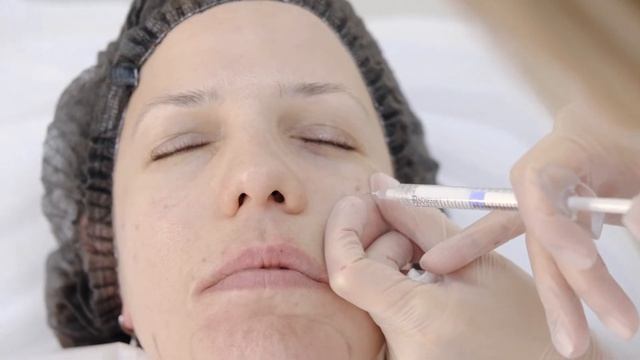 КАК УБРАТЬ ВТОРОЙ ПОДБОРОДОК? Лазерный липолиз подподбородочной зоны. смотреть онлайн