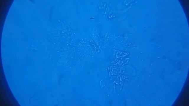 Молочнокислые бактерии под микроскопом смотреть онлайн