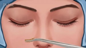ASMR lashes cleaning|eye mucous removal animation