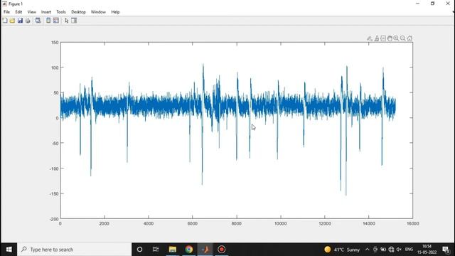 EEG Signal Analysis using MATLAB (Part 1) | PLOTTING an EEG Signal смотреть онлайн