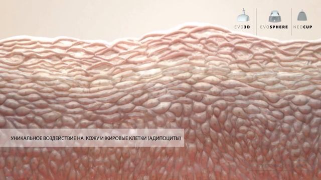 Массаж Starvac для лица и тела в Vidnova смотреть онлайн